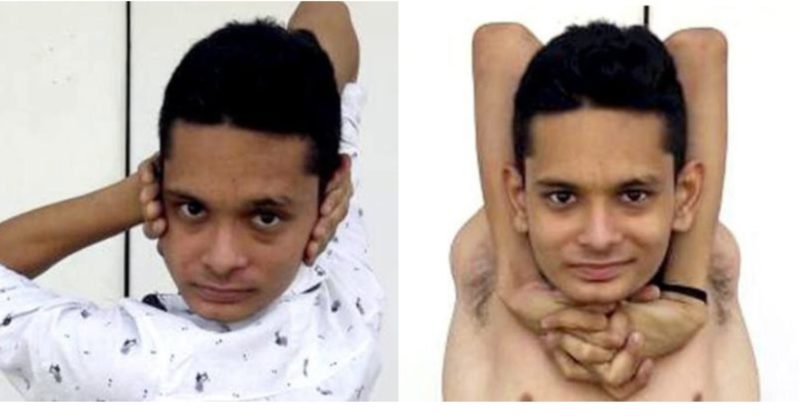 Un jeune Indien a réussi à se tordre les bras et les jambes sous n'importe quel angle
