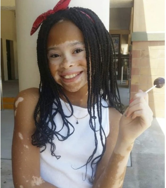 Cette jeune fille mannequin de 13 ans à l'apparence inhabituelle a conquis l'industrie de la mode