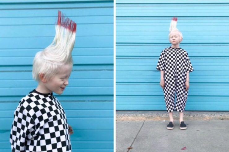 Le petit garçon aux cheveux blancs qui fait fondre les cœurs